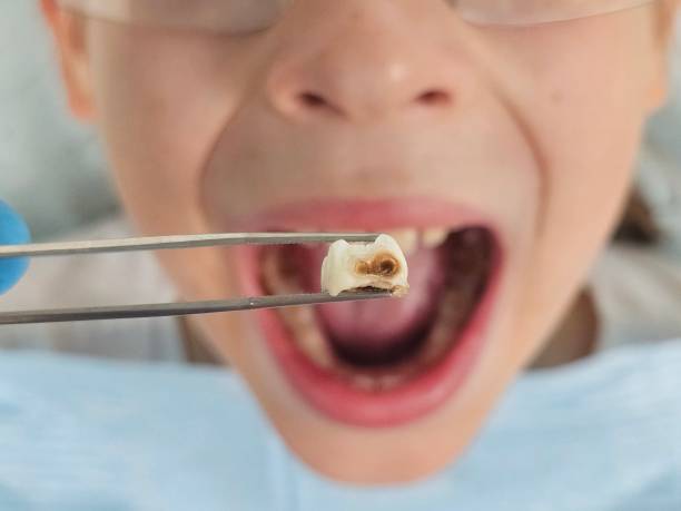 Professional Emergency Dental Service in MI